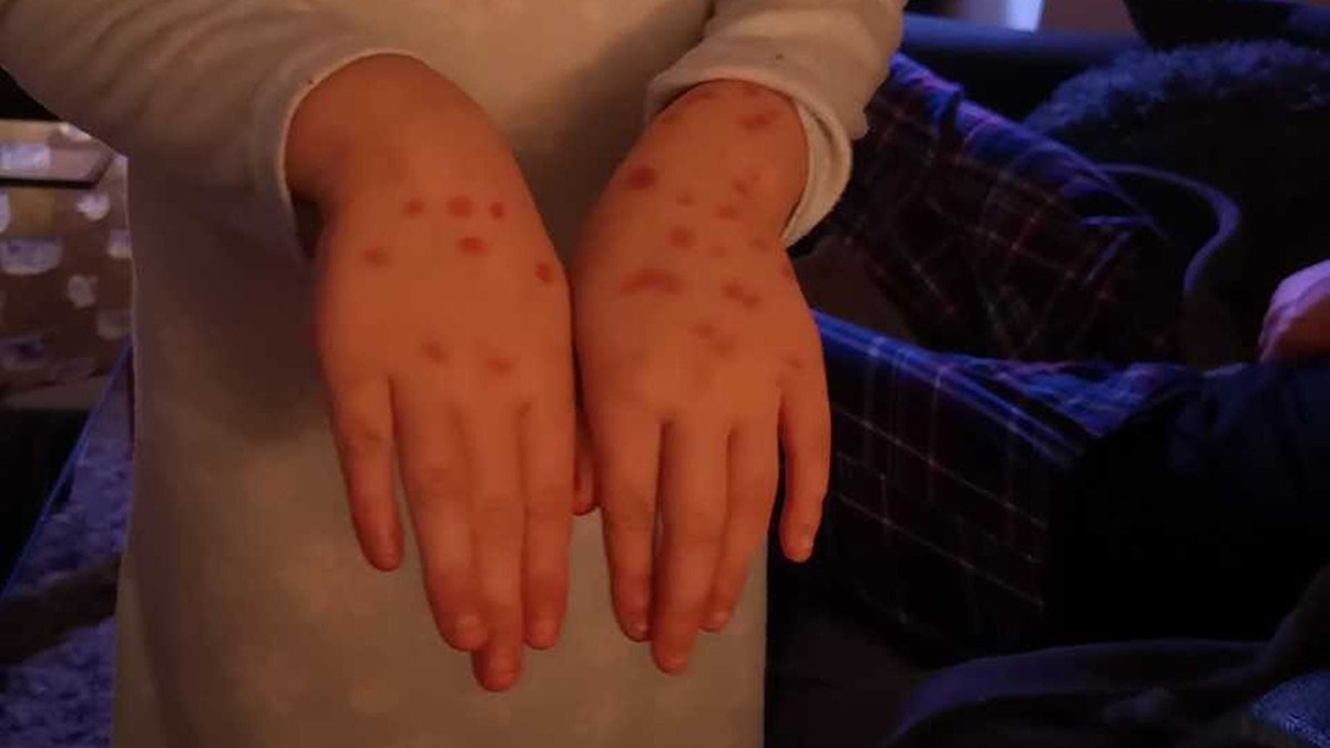 Her parents say she got the idea from a YouTube clip, and figured since several of her classmates were out sick her case would be believable.