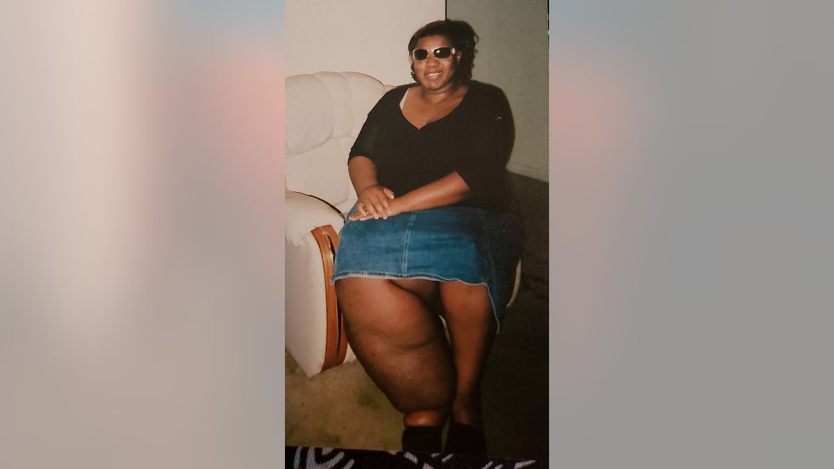 Thompson said her mother took her to countless doctors when she was a child, but they couldn't stop the swelling.