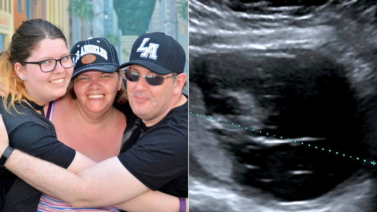 Rebecca Woodthrope, pictured far left with her parents, claims that for years doctors had dismissed her complaints as menstrual pain before the massive cyst was discovered during an ultrasound of her kidney.