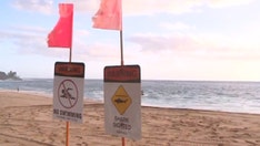 California woman bitten by shark in Hawaii after knocked from kayak