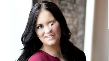 Texas woman who suffered third-degree burns after falling on curling iron opens up about harrowing injury