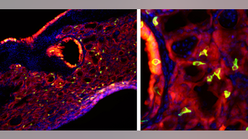 After a bout of flu, mice grow taste bud cells in their lungs