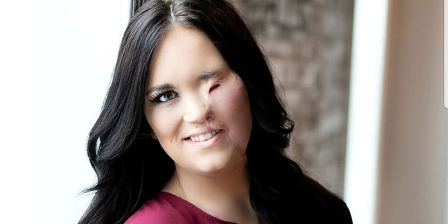 “I'm going to be beautiful and show everyone the beauty within me,” Sullivan resolved following the accident.