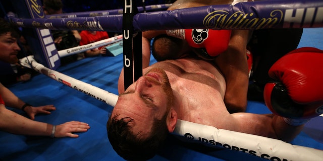 David Price reacts after being bitten by in Kash Ali during their heavyweight bout at M&S Bank Arena on March 30, 2019 in Liverpool, England.