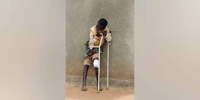 FILE - In this Friday May 13, 1994 file photo a boy who survived a massacre at the Rwandan village of Karubamba rests on his crutches on at a hospital in nearby Gahini, Rwanda. The boy's leg was injured by a machete during the April massacre in Karubamba. Nobody lives here anymore. Not the expectant mothers huddled outside the maternity clinic, not the families squeezed into the church, not the man who lies rotting in a schoolroom beneath a chalkboard map of Africa. (AP Photo/Jean-Marc Bouju, File)