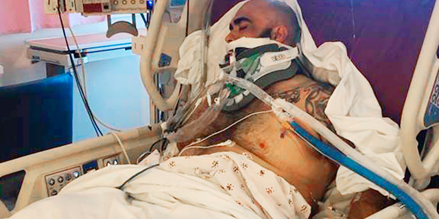 This undated photo provided by the Reyna family shows Rafael Reyna in his hospital bed at Los Angeles County-USC Medical Center in Los Angeles, after his beating outside Dodger Stadium. Bryan Stow, a San Francisco Giants fan who was left disabled in an attack outside Dodger Stadium that drew national attention eight years ago, said he's dismayed that Los Angeles police are again investigating an assault at the baseball stadium that left a man seriously injured. Authorities searched Monday, April 1, 2019, for a man who punched Rafael Reyna during an argument following Friday night's game. Christel Reyna says her husband Rafael sustained a skull fracture and is on life support.(Courtesy Reyna Family via AP)