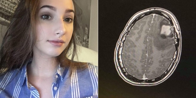 Hiley said she was forced to postpone her studies when the pain was causing her to vomit.