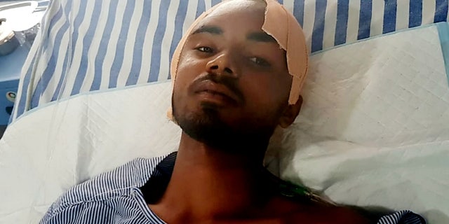 Bahe is said to be "doing fine," and is being monitored for any post-op complications.