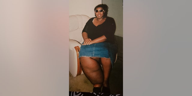 Thompson said her mother took her to countless doctors when she was a child, but they couldn't stop the swelling.