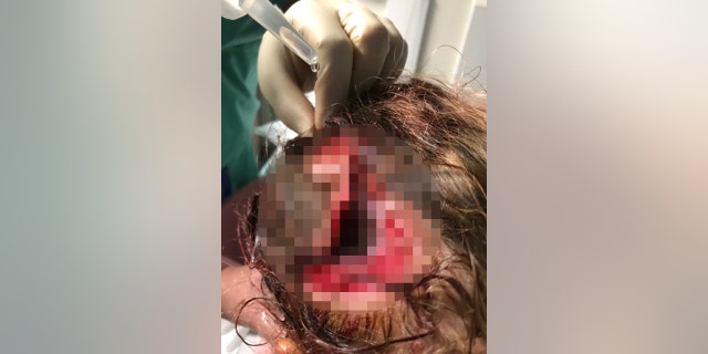 Lani's mother said the accident was like watching a horror movie.