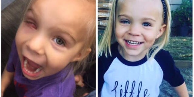 Gracie had her right eye urgently removed and replaced with a painted prosthetic and is now cancer-free.