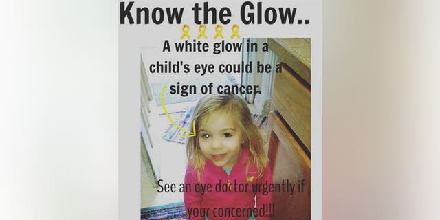 The photo that shows the cancer behind Gracie Corrigan's eye