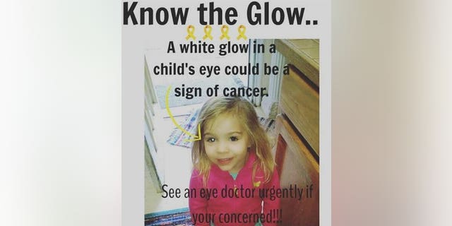 The picture that showed the cancer behind Gracie Corrigan's eye