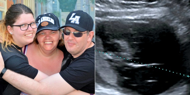 Rebecca Woodthrope, pictured far left with her parents, claims that for years doctors had dismissed her complaints as menstrual pain before the massive cyst was discovered during an ultrasound of her kidney.