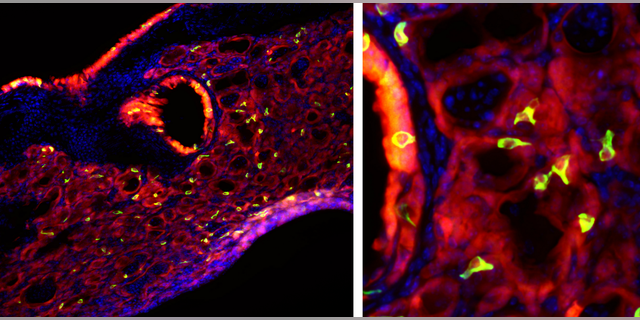 Bright green tuft cells, which are found in taste buds, are seen throughout mouse lung tissue after an infection with the flu.