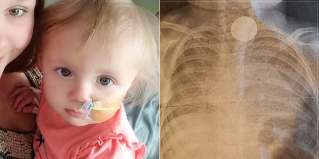 Abigayle's dad reportedly noticed her crying out in pain but hadn't seen her swallow the battery.