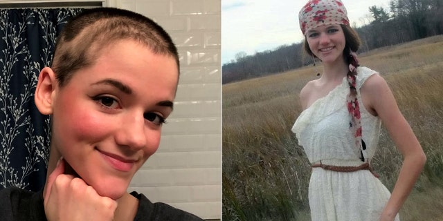 When she began pulling out her lashes as a child, Prosser thought of them as "wishes" she was collecting.<br data-cke-eol="1">