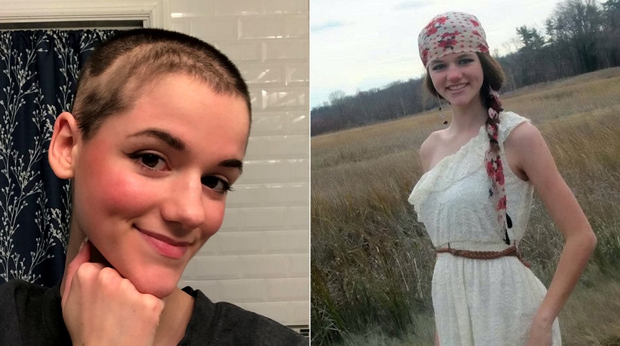 New York woman with hair-pulling disorder shaves head in bid to control urges | Fox News New York woman with hair-pulling disorder shaves head in bid to control urges | Fox News