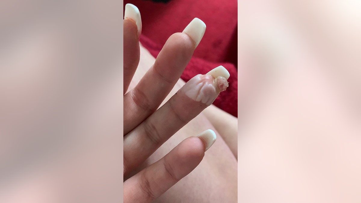 Woman claims botched acrylic nail job nearly cost her a finger: 'I