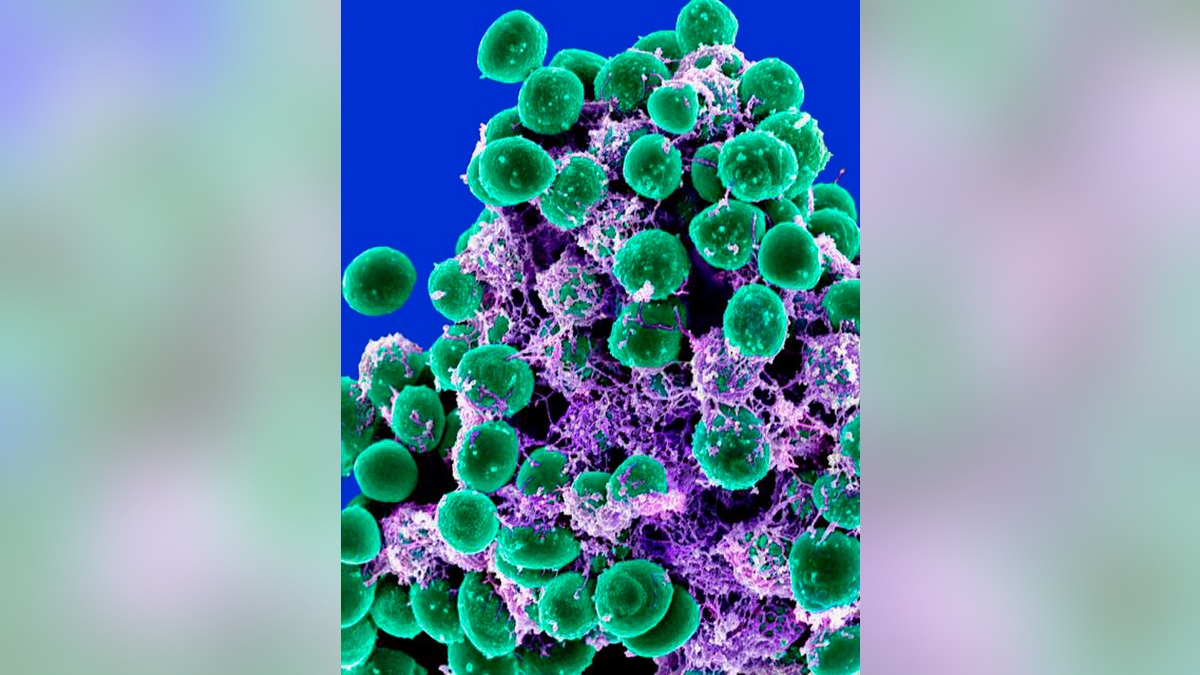 This 2011 digitally-colorized electron microscope image made available by the National Institute of Allergy and Infectious Diseases shows a clump of green-colored bacteria on a purple-colored matrix.