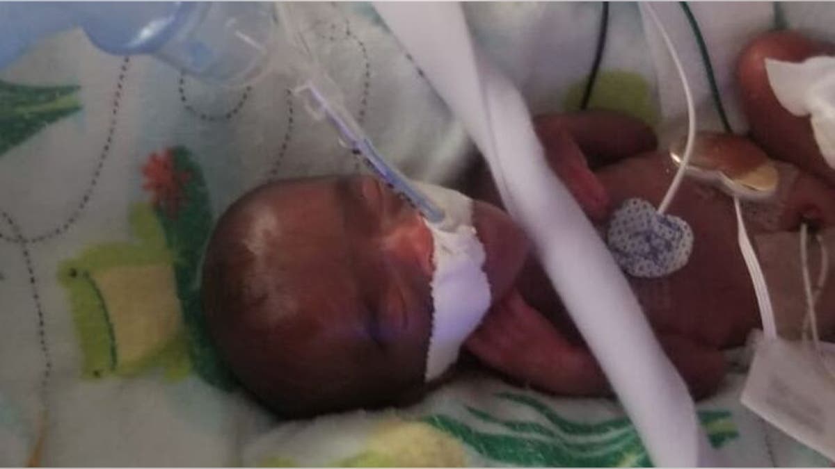 Baby Saybie was believed to be the world's tiniest surviving baby, born at a shocking 8.6 ounces.