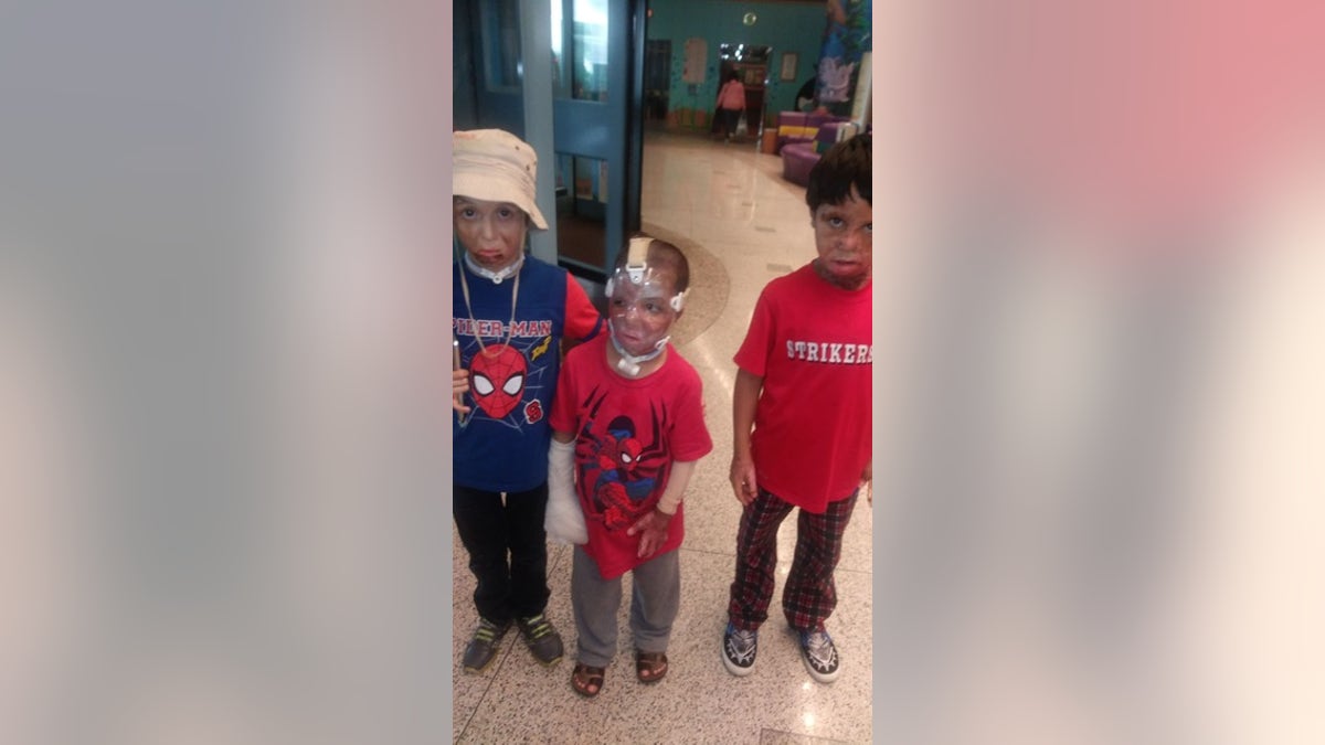 Syrian children are given life-saving treatment in the U.S. thanks to BCRF and Shriners Hospital