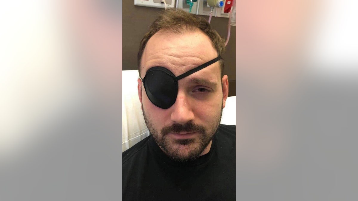 He wore an eye patch to treat blurry and double vision