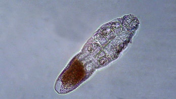 Face mites feast on skin oils, mate while you sleep