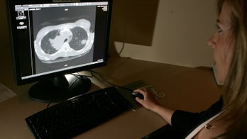 Google AI detected lung cancer better than radiologists, study shows