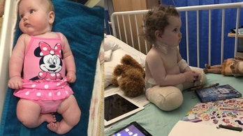 Toddler born with rare birth defect has legs amputated, will be fitted with prosthetics