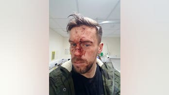 'Blood everywhere': Groom-to-be gets attacked at pub, shows up for wedding the next day