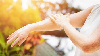Twitter users stunned to discover oddly similar wrist freckle: 'I'm scared'