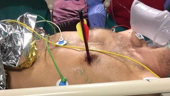 Man in Italy walks into hospital with arrow through heart, somehow survives