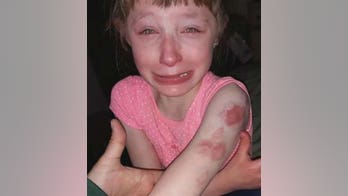 Restrained special-needs student, 10, 'brutally' bitten on school bus while driver did nothing, parents allege