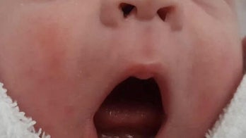 Baby girl born with 2 formed teeth shocks mom, doctors