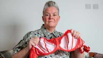 Woman claims tight-fitting underwire bras caused giant cyst, gaping 'hole'