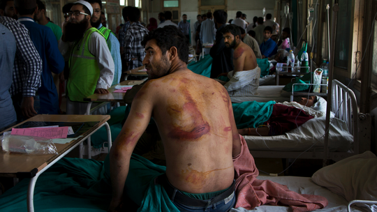 Kashmir group seeks UN probe into torture by India troops