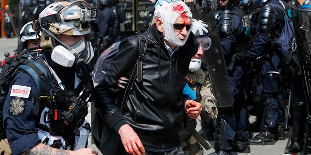 A man, his face covered in blood, is assisted as he walks away during a May Day demonstration in Paris. (AP Photo/Francois Mori)