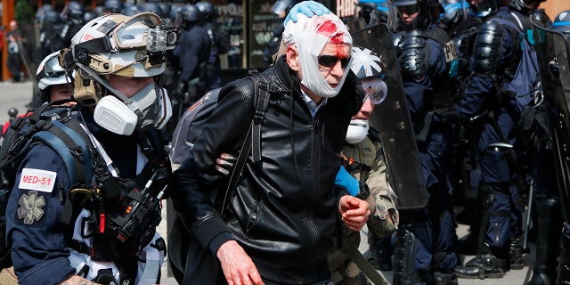 A man, his man's face covered in blood, is assisted as he walks away during a May Day demonstration in Paris. (AP Photo / Francois Mori)