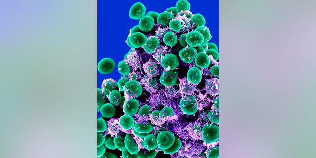 This 2011 digitally-colorized electron microscope image made available by the National Institute of Allergy and Infectious Diseases shows a clump of green-colored bacteria on a purple-colored matrix.