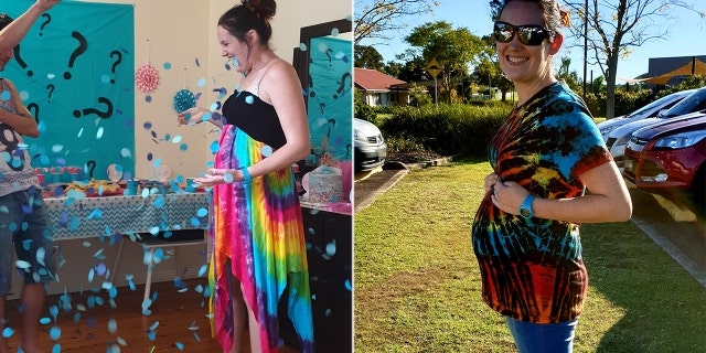 She is now weeks away from giving birth to a baby boy, which doctors had warned might not be possible due to the amount of scarring left behind by SJS.