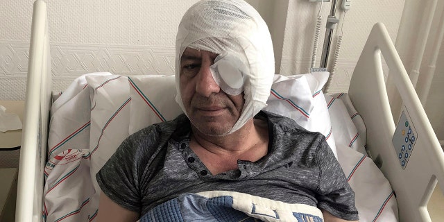 Yavuz Selim Demirag, a Turkish journalist critical of President Recep Tayyip Erdogan's government and its nationalist allies, rests in a hospital bed in Ankara, Turkey, Saturday, May 11, 2019. Yenicag newspaper says Saturday columnist Demirag was beaten by a group of about five or six people with baseball bats outside his home after appearing on a TV show late Friday.(AP Photo/Burhan Ozbilici)