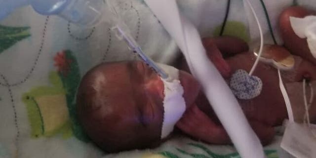World's smallest surviving baby goes home 5 months after birth