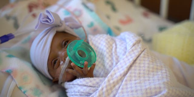 World's smallest surviving baby goes home 5 months after birth