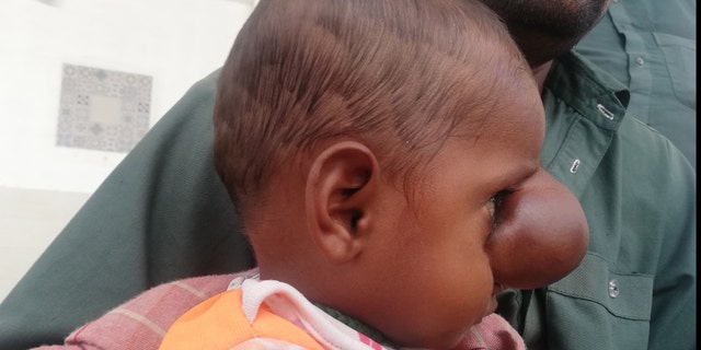 Surgical intervention is typically necessary in these cases, but his parents were turned away from several hospitals before they landed at Jinnah Postgraduate Medical Center in Karachi.