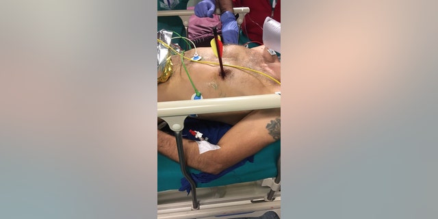It remains unclear how the man got hit with the arrow, which doctors successfully removed.