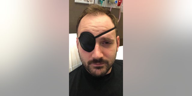 He wore an eye patch to treat blurry and double vision