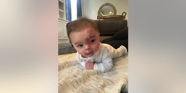 Leo is on anti-seizure medication which doctors hope will protect him from having a stroke.
