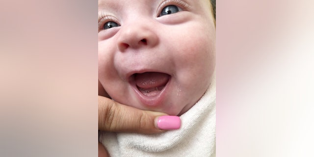 Emilia had the teeth removed within hours of her birth.