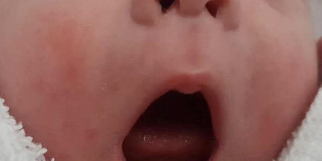 Emilia Harper Jaymes Bridge shocked her mother and doctors when she was born with two teeth.